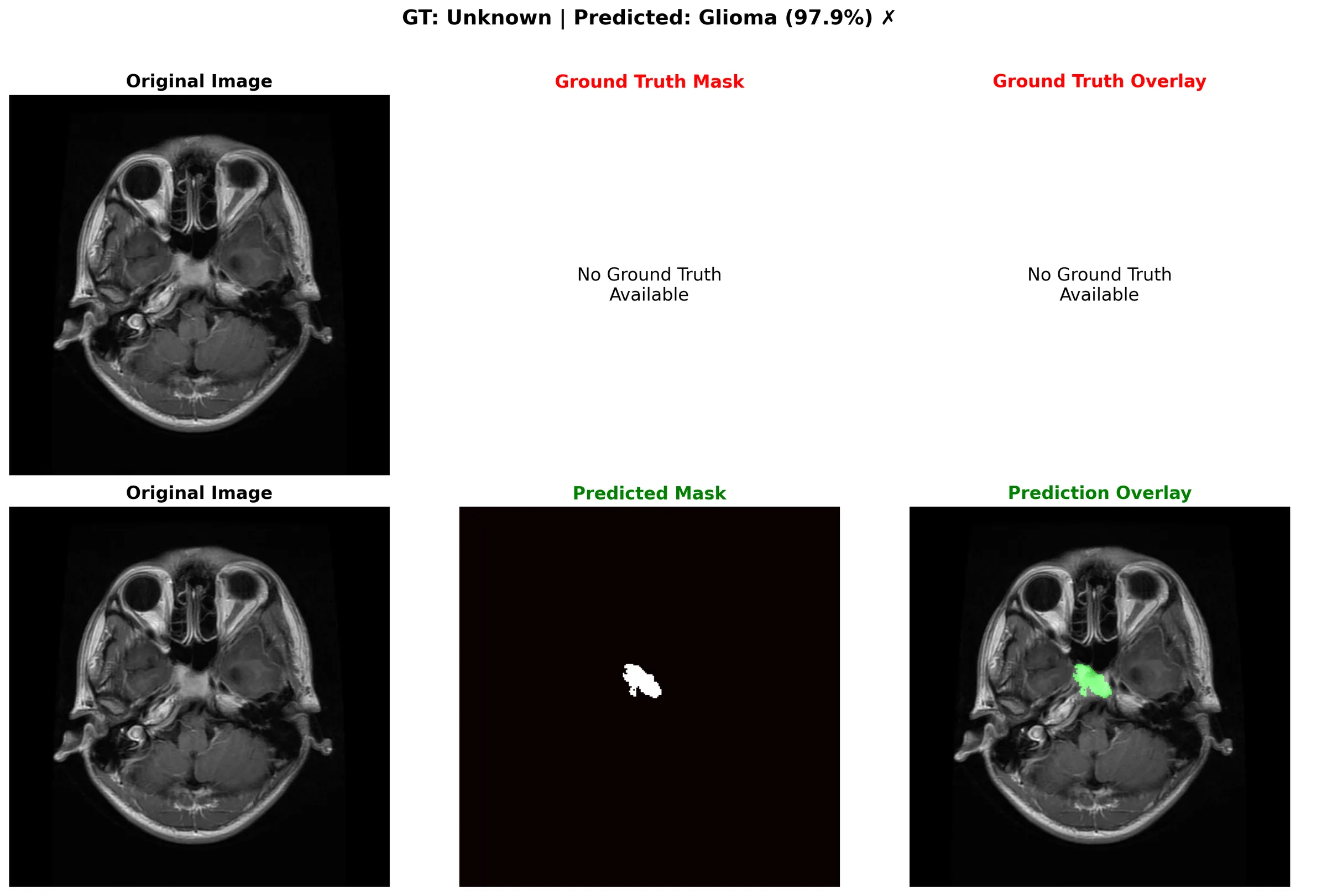 Brain Tumor Segmentation & Classification interface