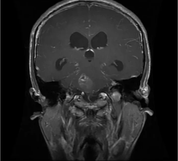 Input MRI